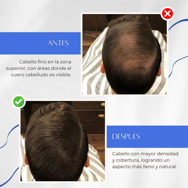 🔥KIT-TOPPIK™ – Fibra Capilar 3 en 1: Volumen Instantáneo + Aplicador + Peine Delimitador