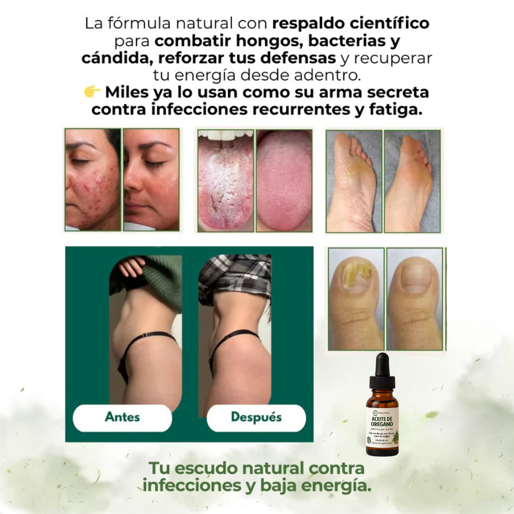 Aceite de oregano