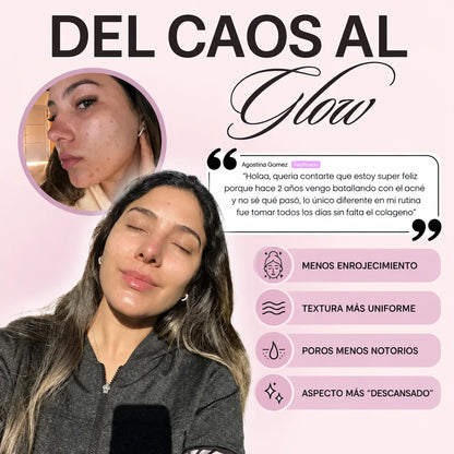Glow Up Era® – Colágeno Beauty Complex + Ácido Hialurónico
